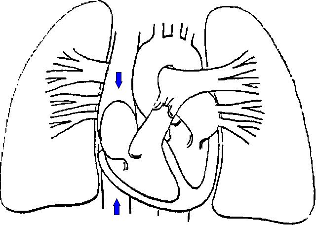an animation depicting the blood flow between the heart and lungs