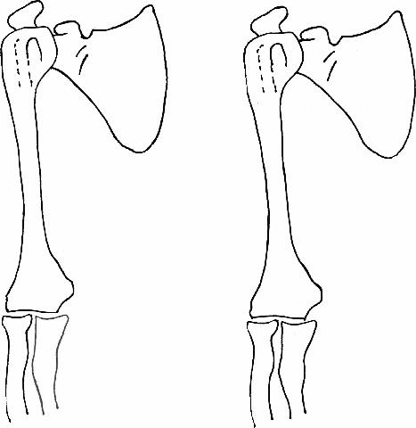 a diagram of the bones needed to draw the structures of the arm