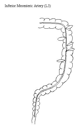 a blank drawing of the colon on which to draw the branches of the inferior mesenteric artery