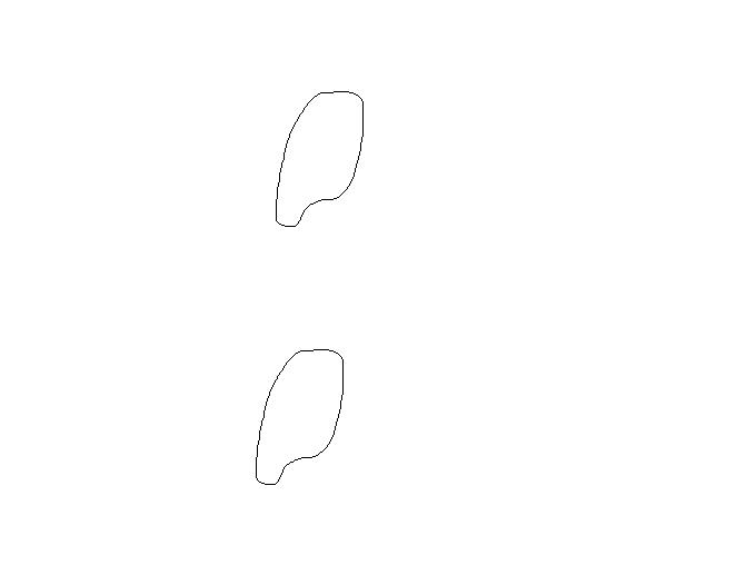 a blank diagram of two ribs on which to draw the layout of the intercostal neurovasculr bundle