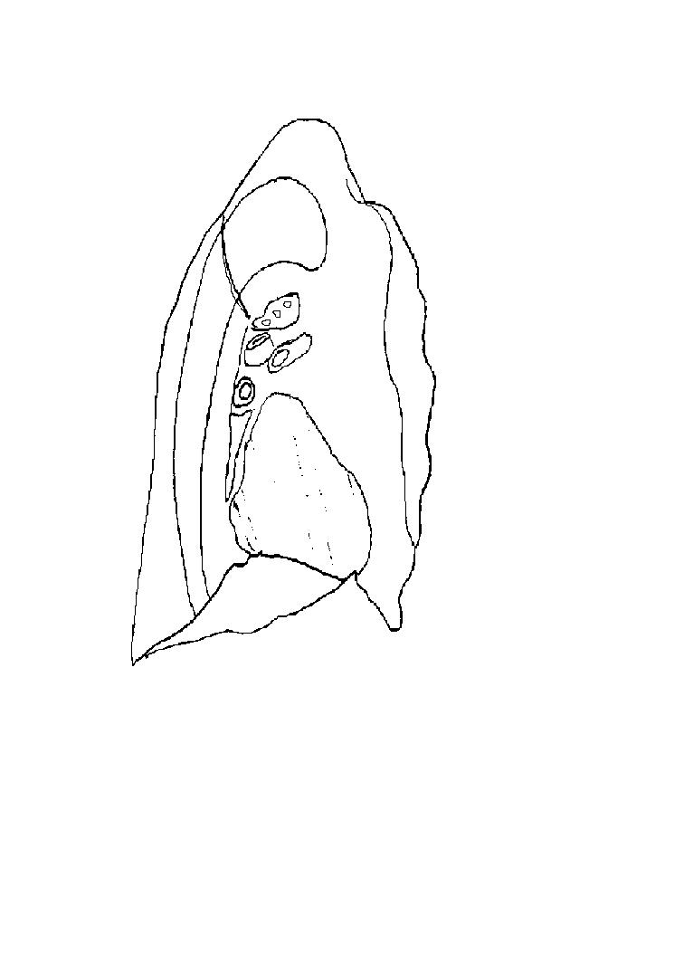 an unlabeled drawing of a medial view of a left lung