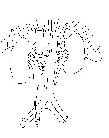 an unlabeled diaagram of the  abdomial aorta on which to add the paired and unpaired btanches