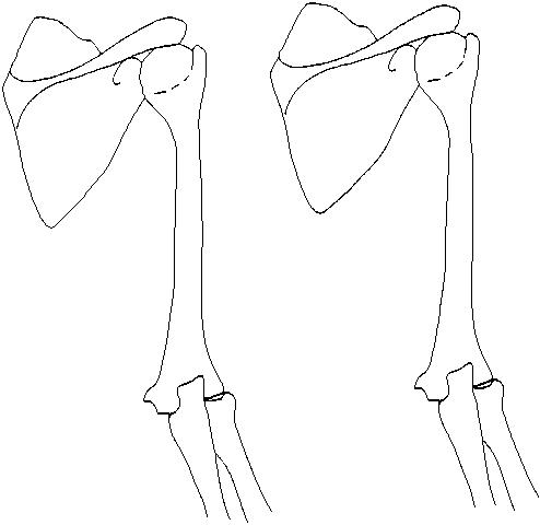 a drawing of the bones associated with the muscles of the posterior arm on which to draw the muscles of the posterior arm
