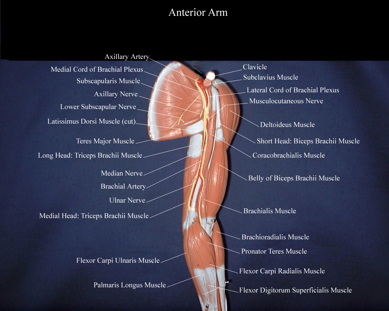 a picture of a model of the anterior arm