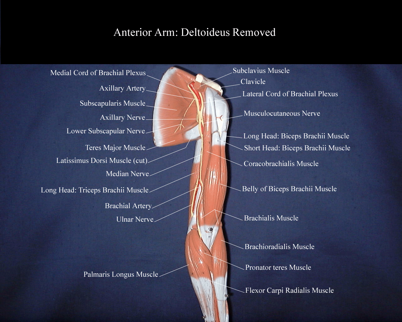 a picture of a model of the anterior arm with the deltoideus muscle removed