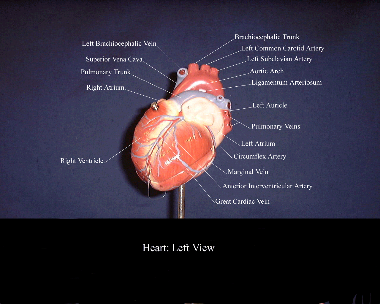 a picture of a heart model showing the structures from an anterior and left angle