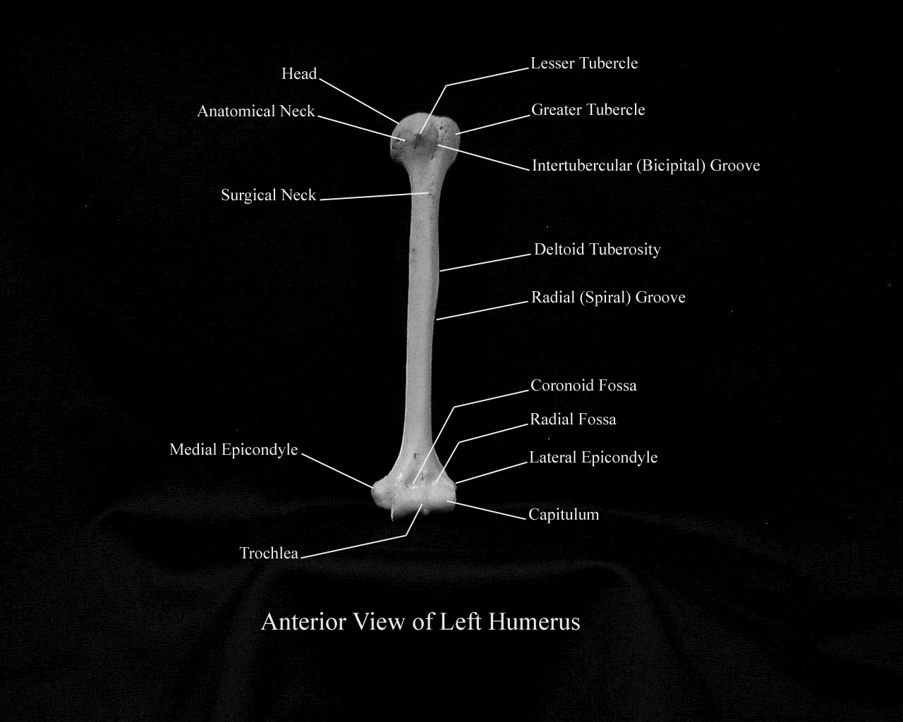 a picture of an anterior view of a humerus with the structures labeled