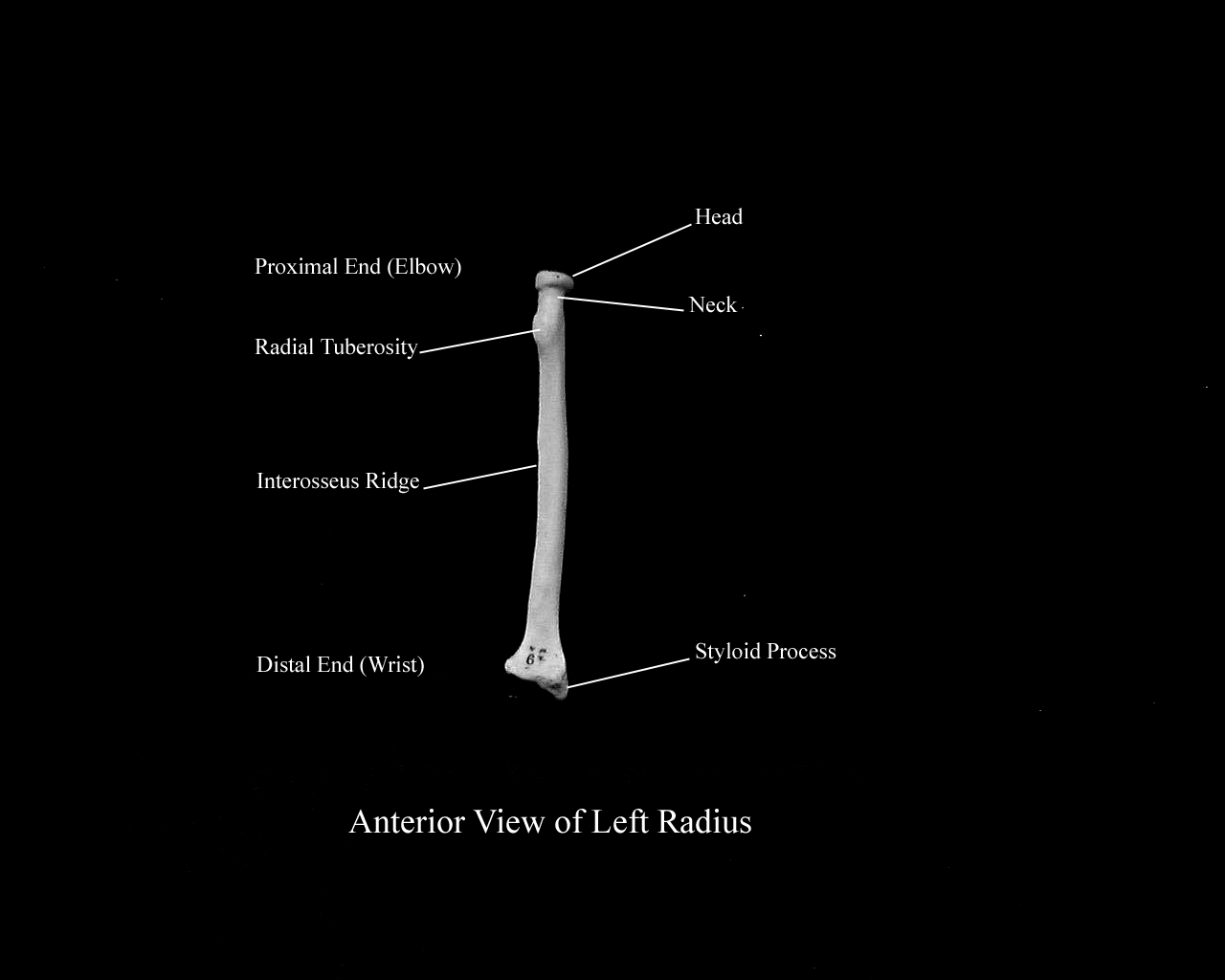 a labeled picture of an anterior view of a radius