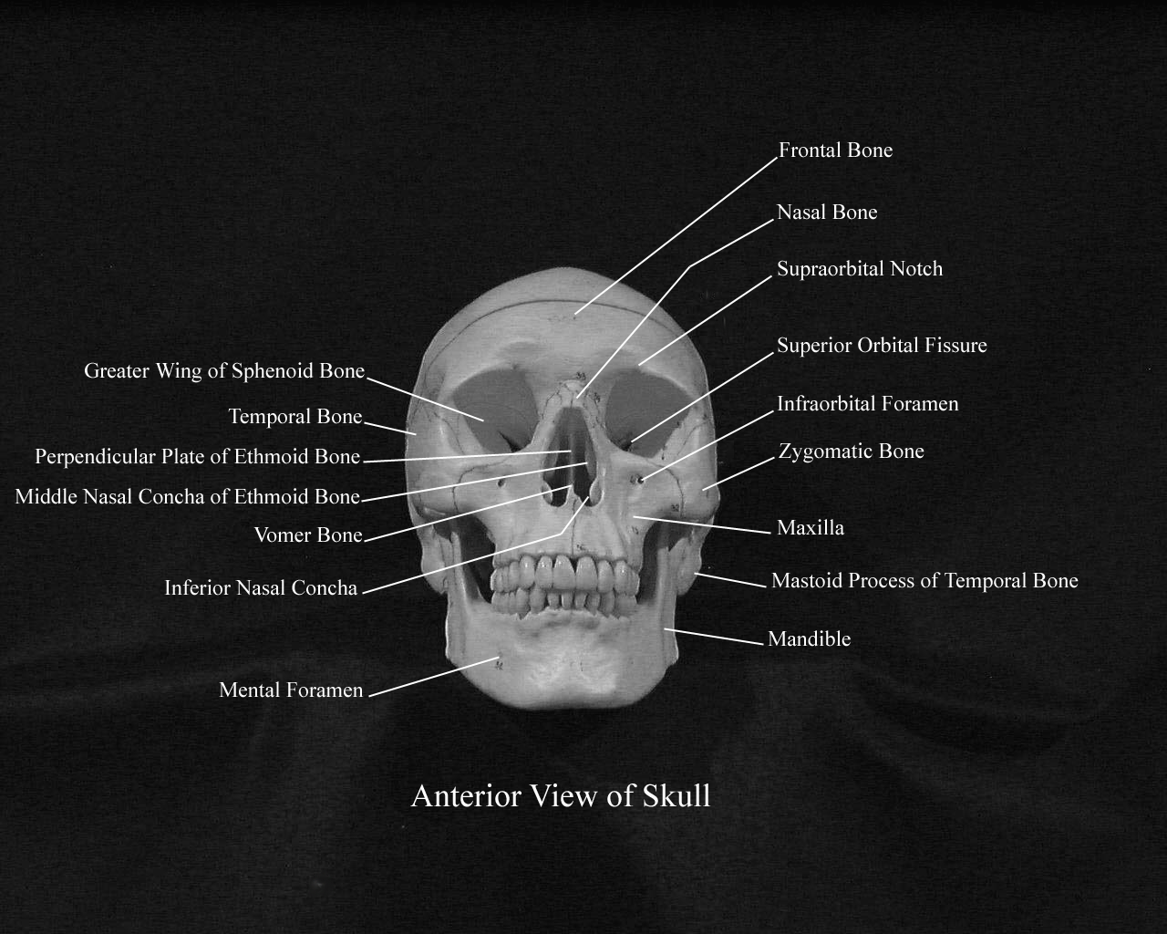 alabeld picture of the skull from an anterior view