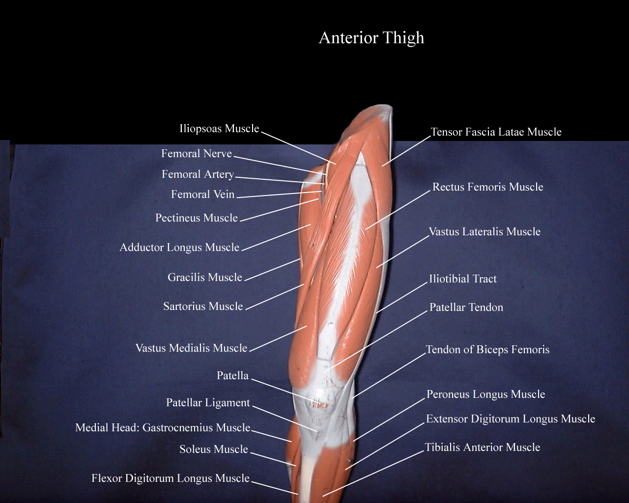 a labeled picture of a lower extremity model indicating the muscles in the superficial layer of the anterior thigh