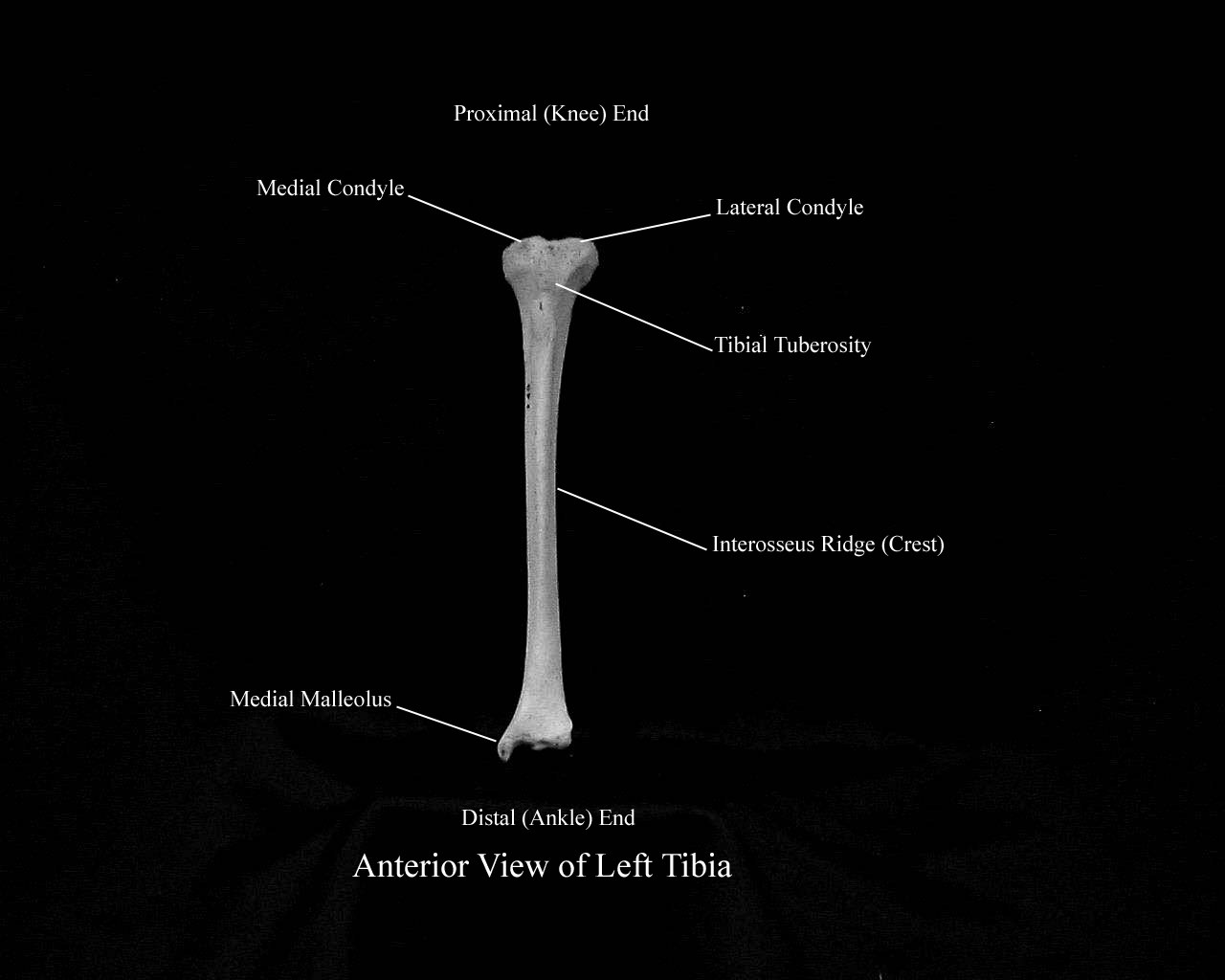 a labeled picture of an anterior view of a tibia