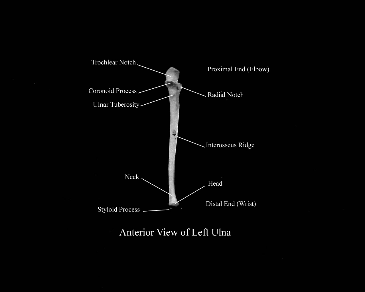 a labeled picture of an anterior view of an ulna