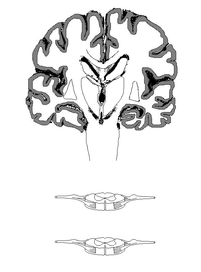 a diagram of the spinal cord and brain on which to draw the corticospinal trcacts