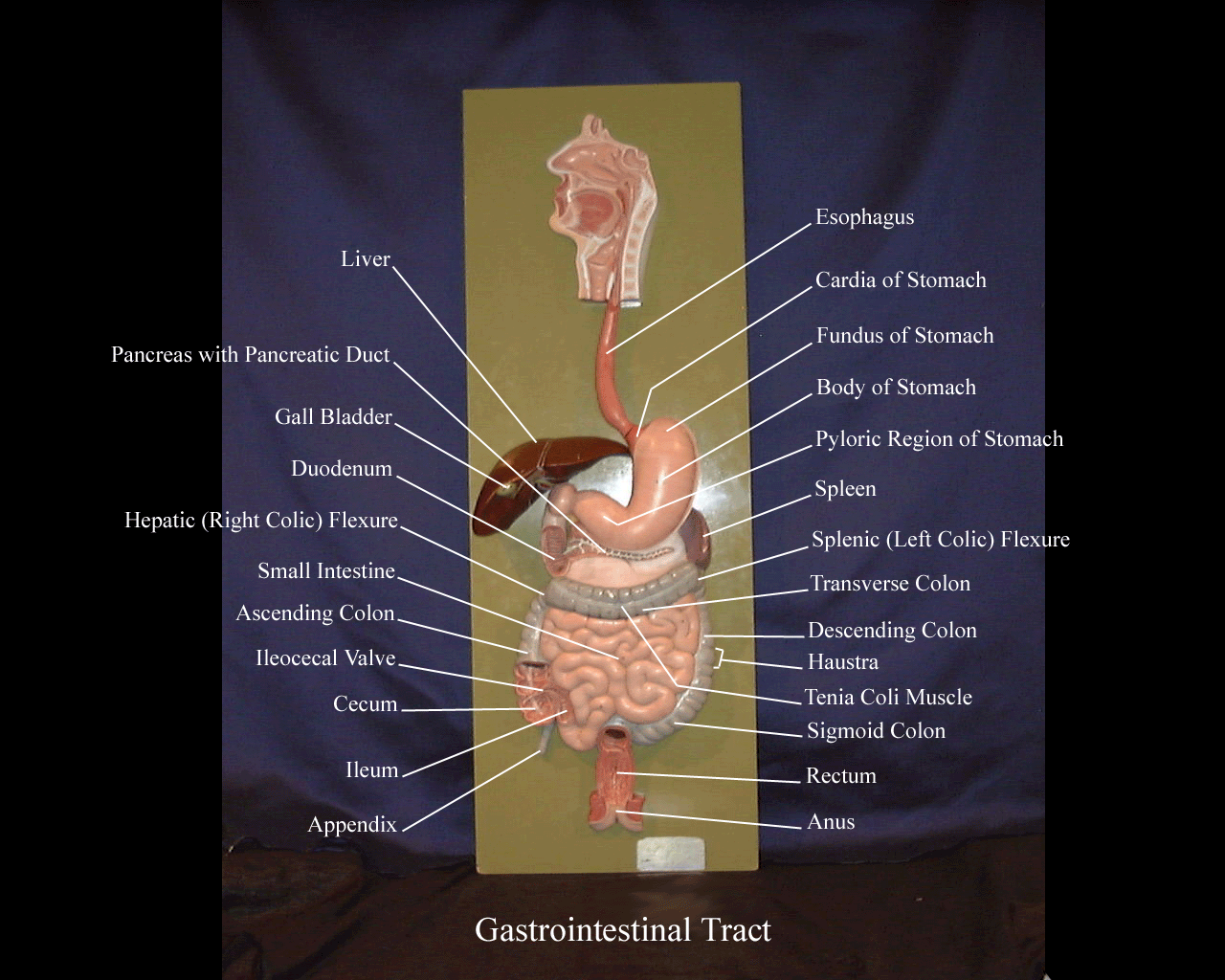 a labeled picture of the digestive system plaque