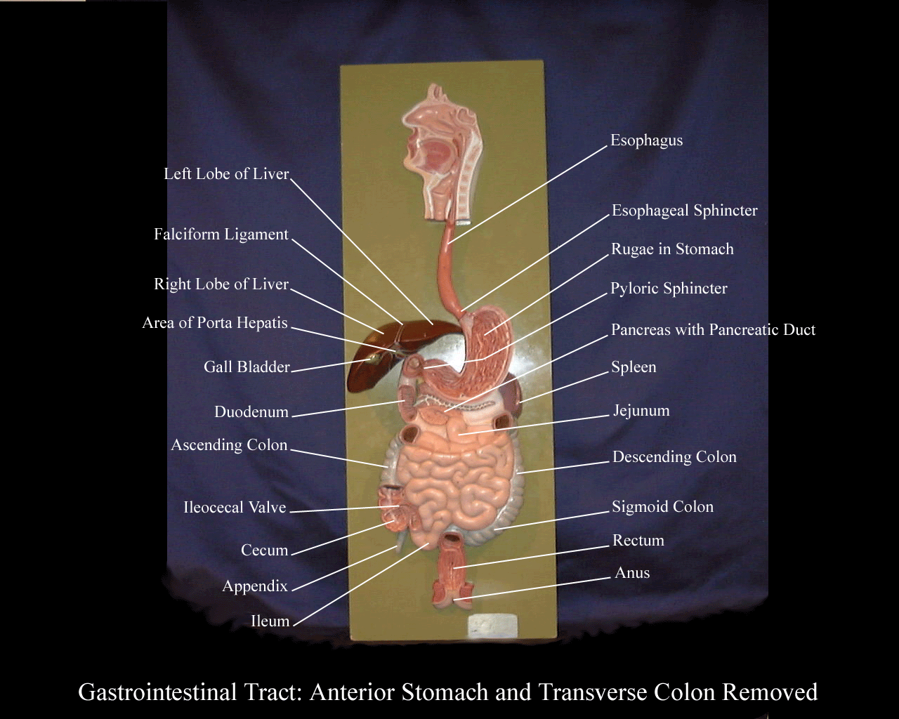 a labeled picture of the digestive system plaque with the stomach open and the transverse colon removed