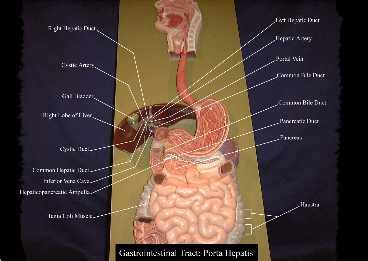 a labeled picture of the digestive system plaque focusing on the area of the posterior liver