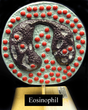 a picture of a model of an eosinophil