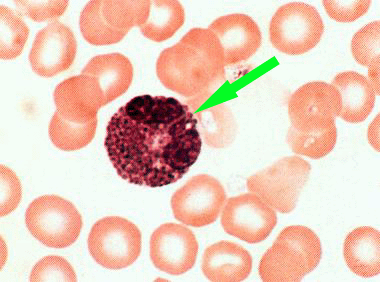 a photomicrograph of an eosinophil