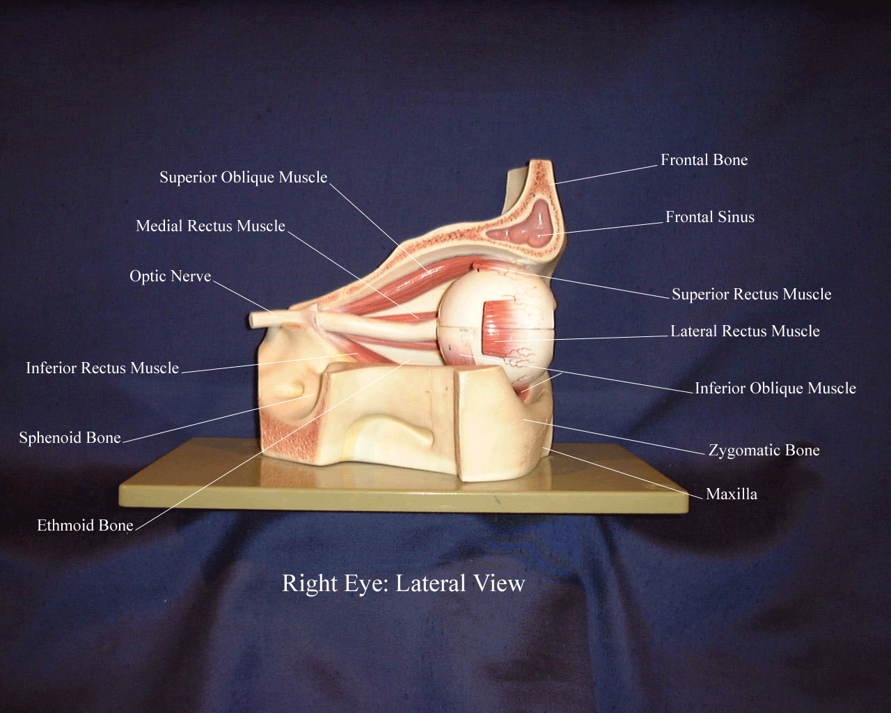 a labeled picture of the extrinsic muscles of the eyeball from a lateral view with the lateral rectus muscle removed