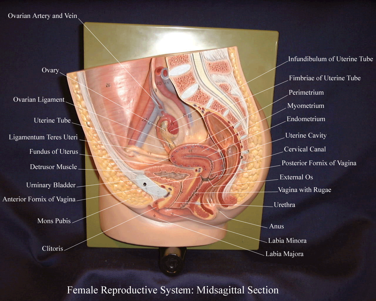 a labeled picture of a female reproductive model with the removable pieces taken off