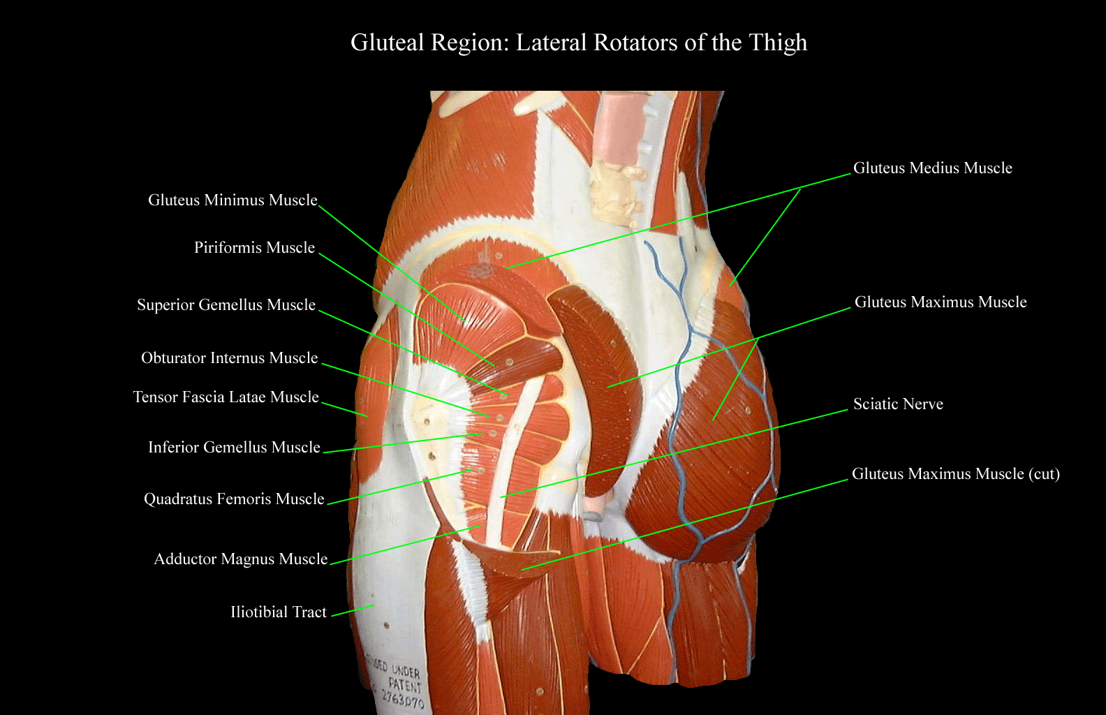 a labeled picture of the gluteal muscles on a torso model