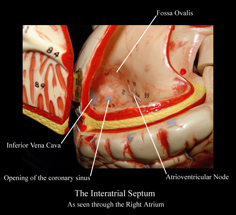 a labeled picture of a heart model focusing on the structures in the right atrium