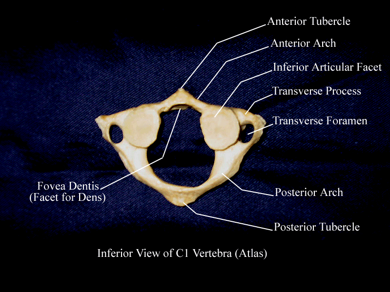 an labeled pitcure of an inferior view of the first cervical vertebra