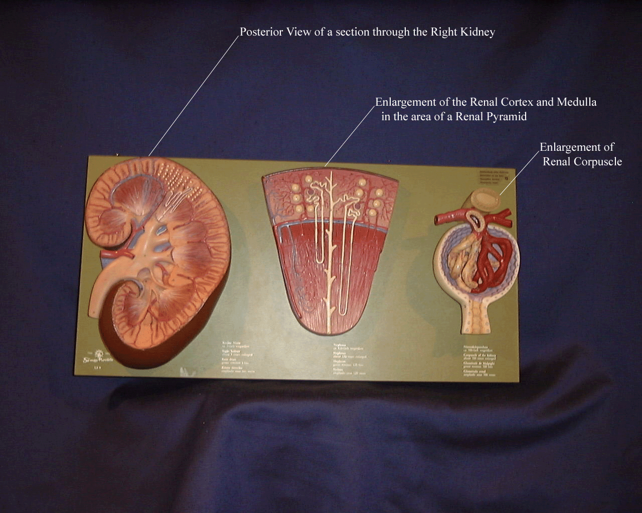a picture of the kidney plaque showing three magnifications of the kidney structures