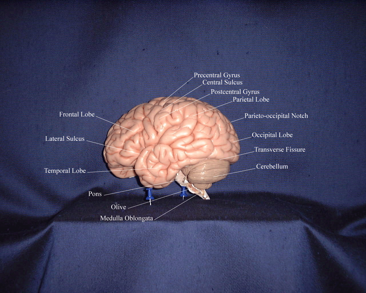 a labeled picture of the left side of a brain model