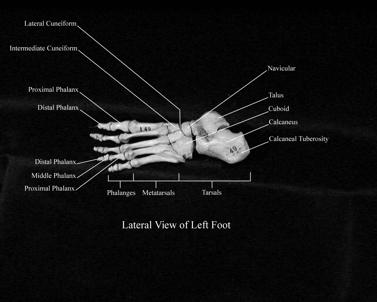 a labeled picture of the bones of the foot from a lateral view