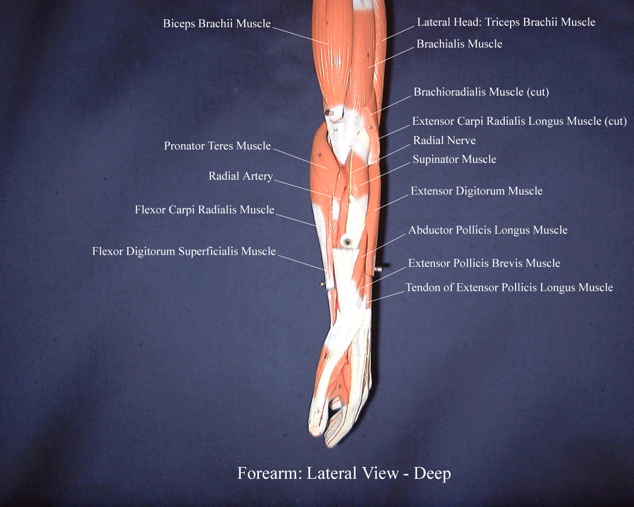 a labeled picture of a forearm model showing the deep muscles of the forearm from a lateral view