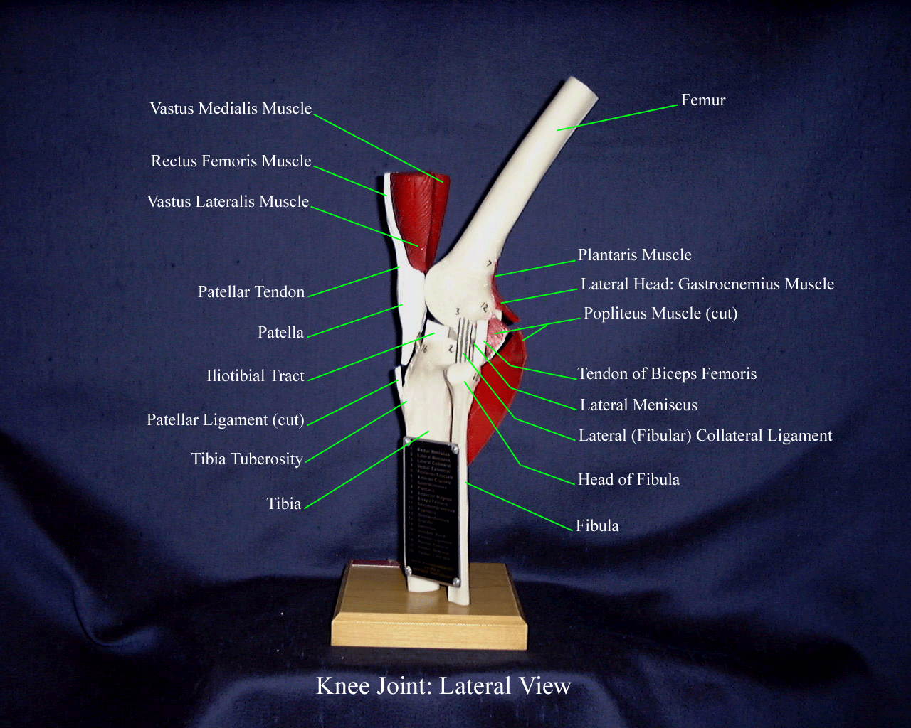 a labeled picture of a knee model from a lateral view