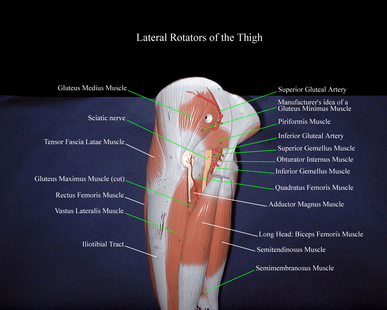 a labeled picture of a model of the gluteal region focusing on the deep lateral rotators