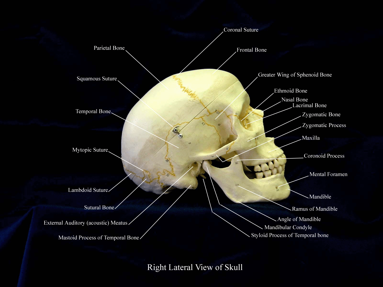 a labeled picture of the left side of a skull