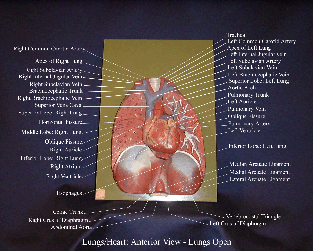 a labeled picture of an anterior view of a lung plaque with the anterior portions of the lungs removed