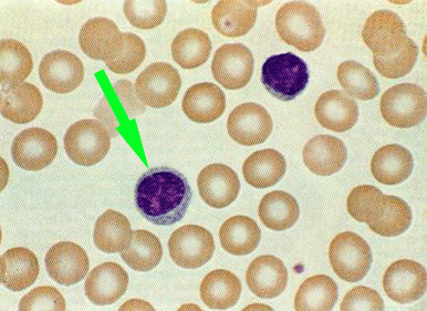 a photomicrograph of lymphocytes and red blood cells