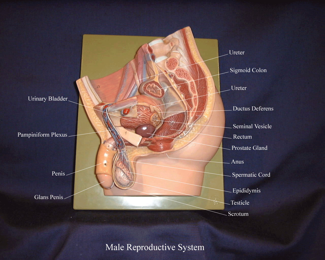 a labeled picture of a male reproductive system plaque
