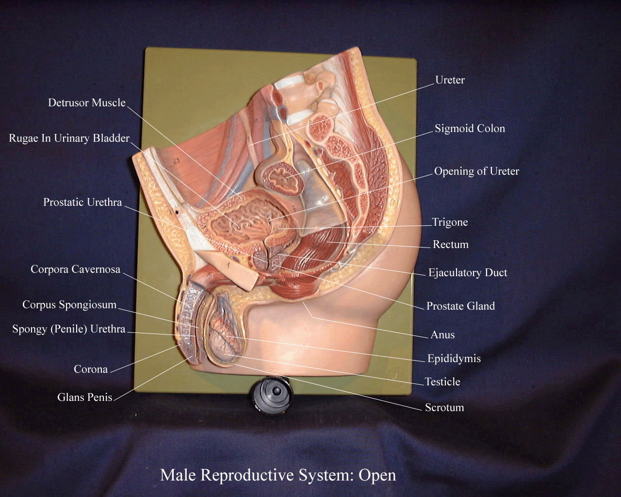 a labeled picture of a midsagittal section through a male reproductive system plaque