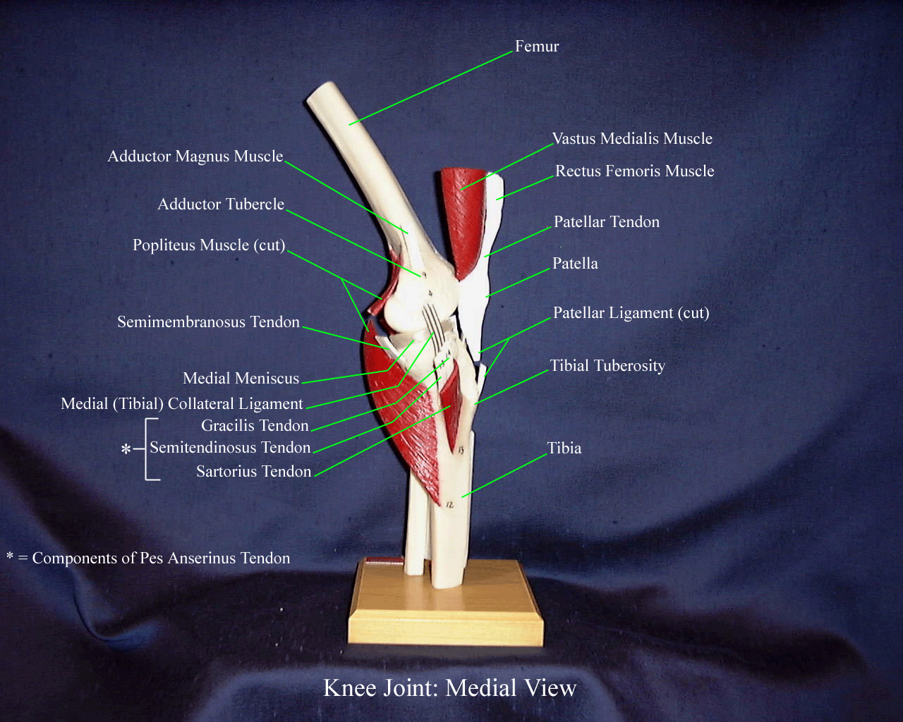 a labeled picture of a knee model indicating the structures of the medial side of the knee
