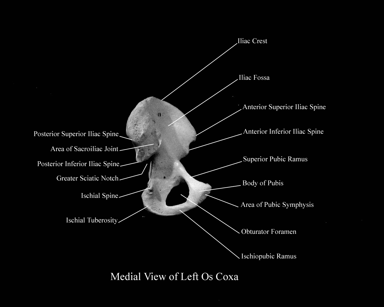 a labeled picture of an os coxa from a medial view