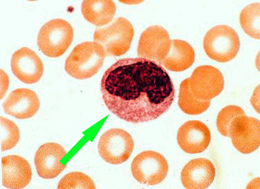 a photomicrograph of a monocyte