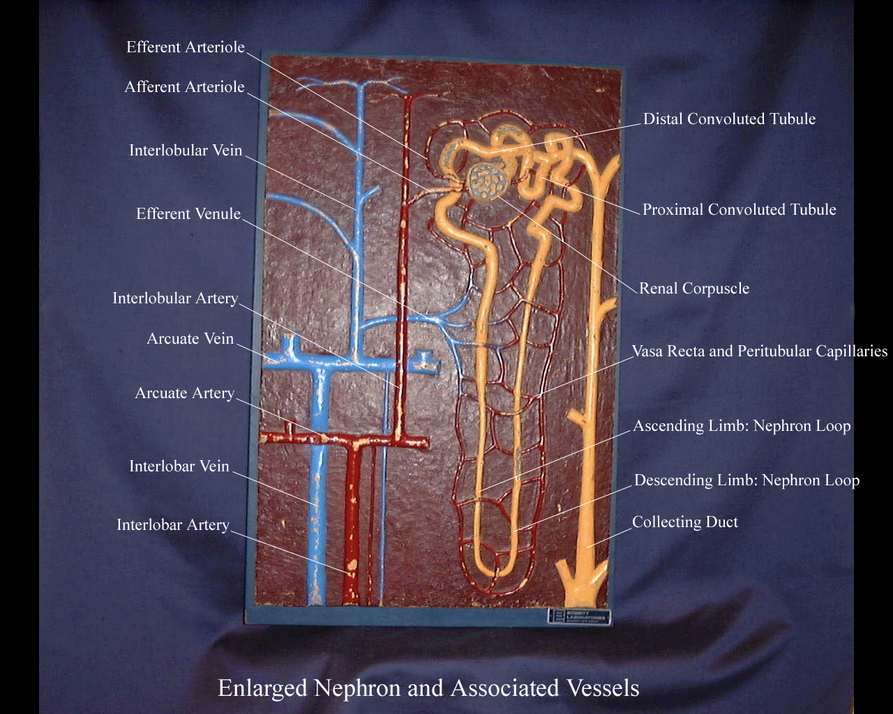 a labeled picture of a large nephron plaque