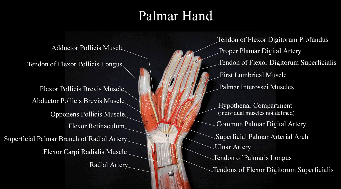 a labeled picture of a palmar view of the hand on an upper extremity model
