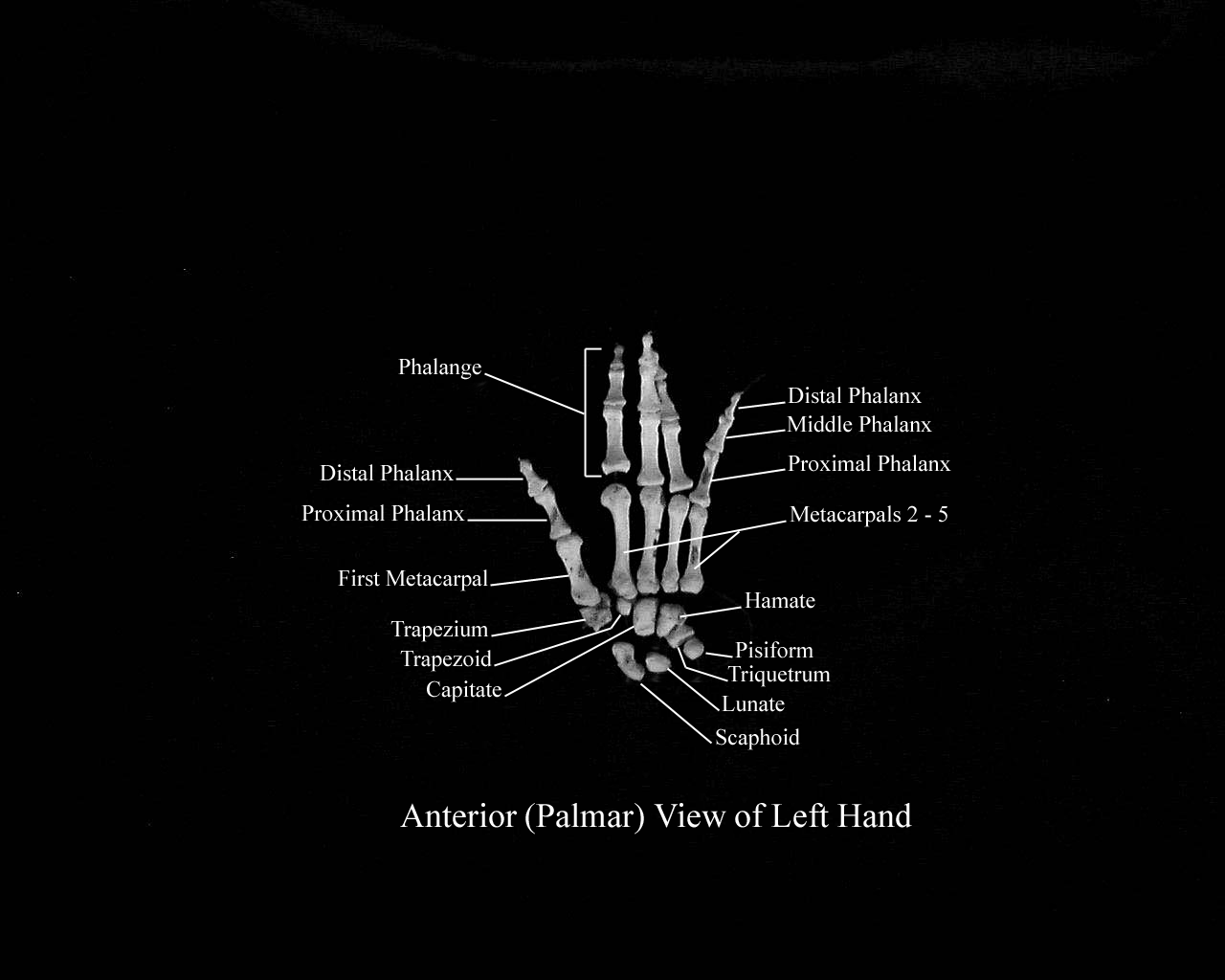 a labeled picture of the bones of the hand from a palmar view