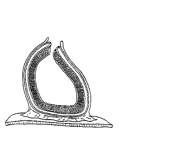 an unlabeled diagram of the pericardial sac