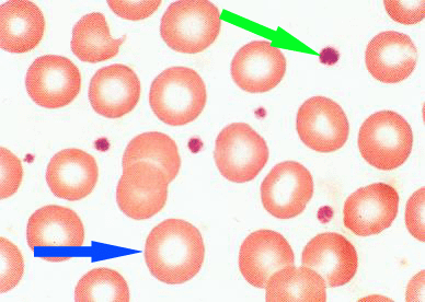 a photomicrograph of platelets and red blood cells