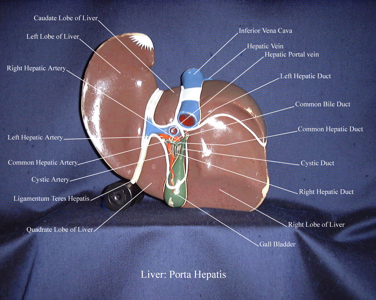 a labeled picture of a liver model from a posterior inferior view