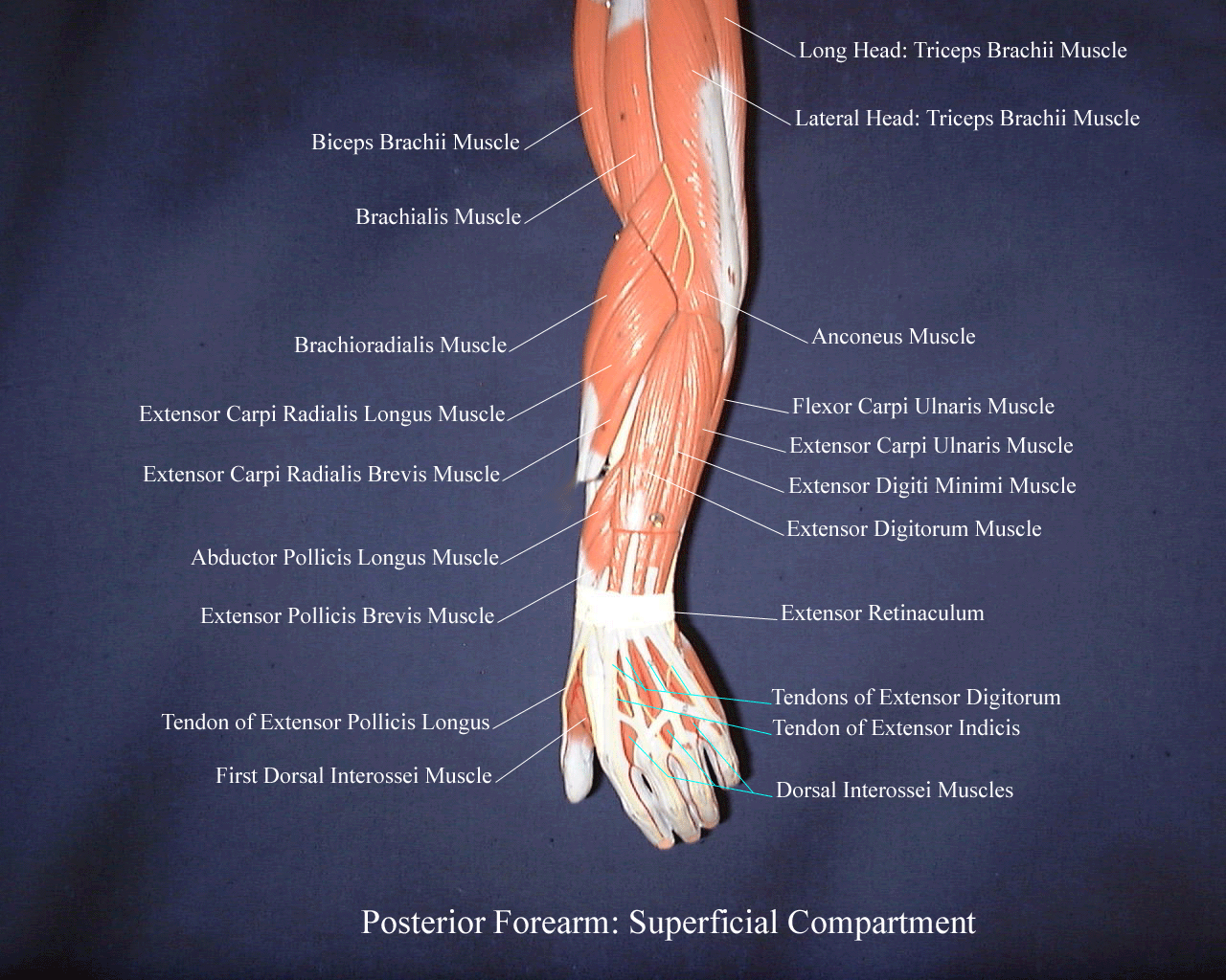 a labeled picture of a model of the superficial muscles of the posterior forearm