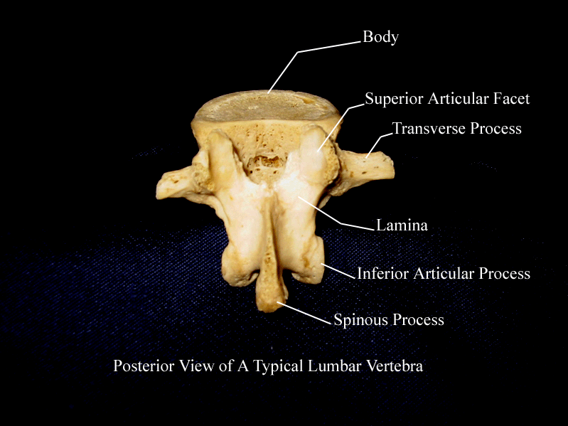 a labeled picture of a posterior view of a lumbar verterbra