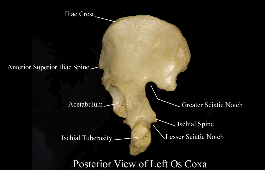 a labeled picture of a posterior view of an os coxa